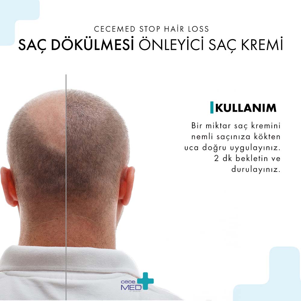Saç Dökülmesi Önleyici Krem-3410