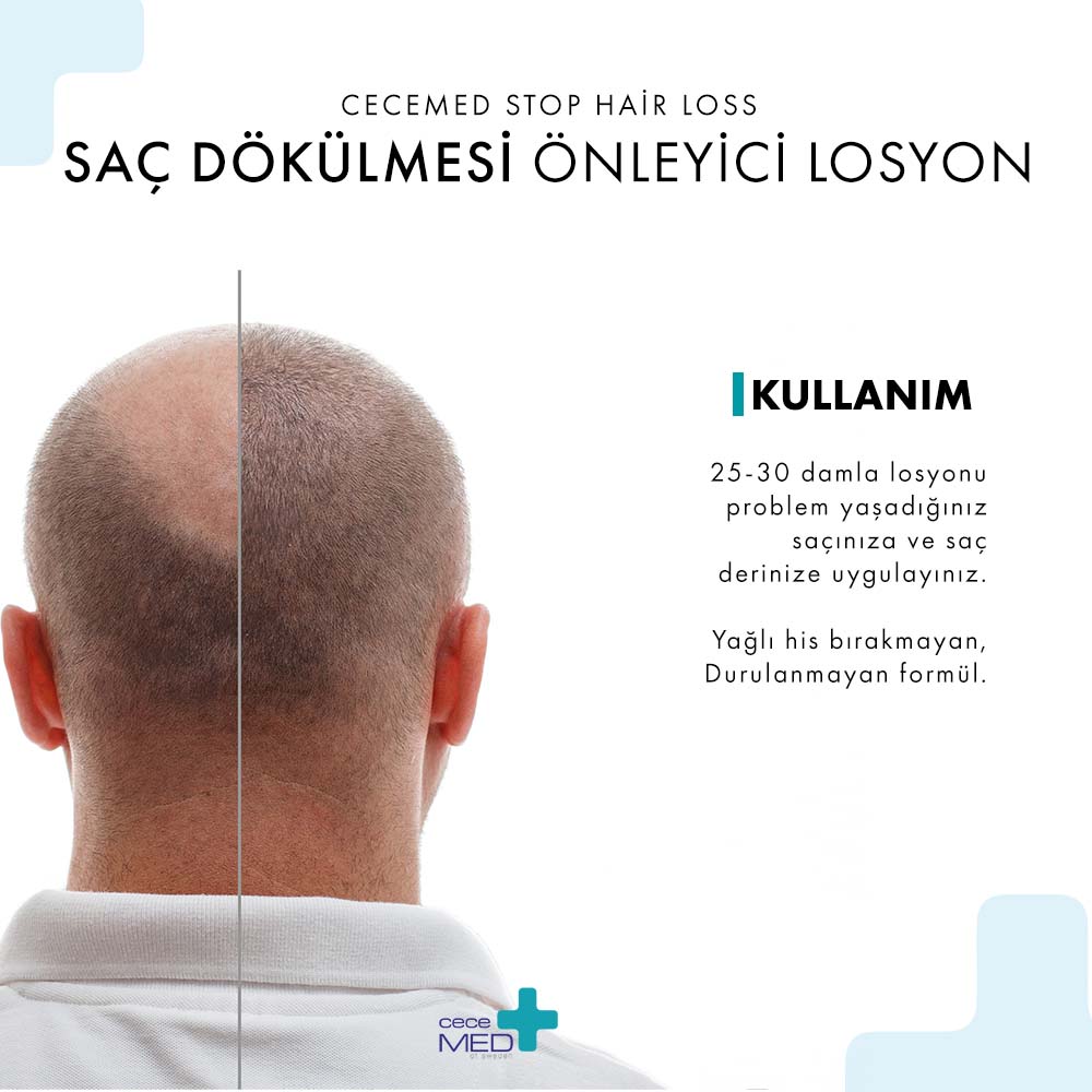 Saç Dökülmesi Önleyici Losyon-3430